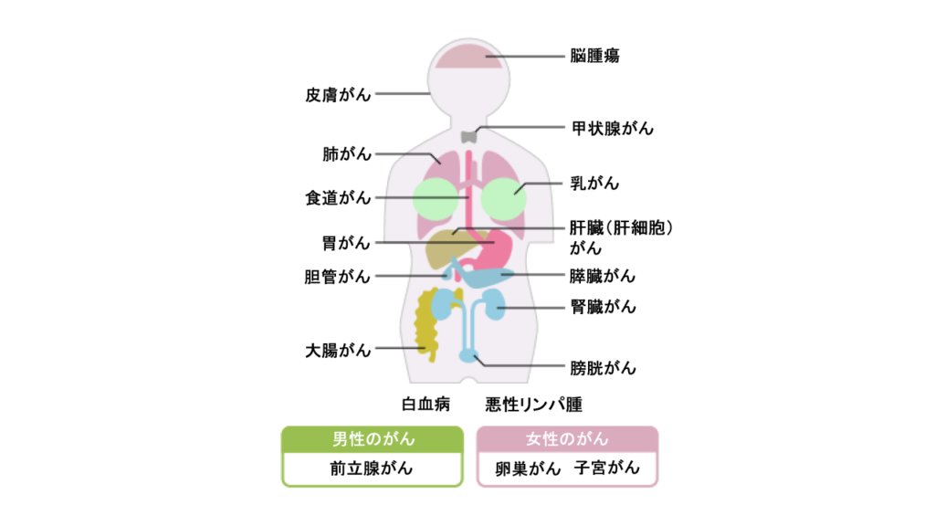 がん保険の基礎知識 | ファイナンシャルプランナーJP